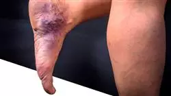 ##IMAGE##