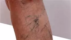 ##IMAGE##