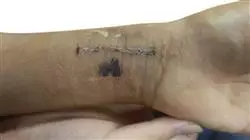 ##IMAGE##