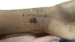 ##IMAGE##