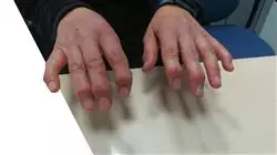 ##IMAGE##