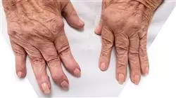 ##IMAGE##