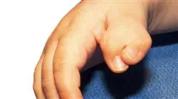 ##IMAGE##