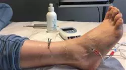##IMAGE##