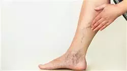 ##IMAGE##