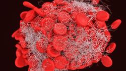 diplomado trombosis era genomica i estudios globales genoma gwas