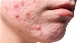 ##IMAGE##