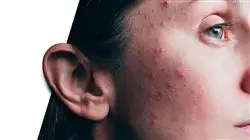 ##IMAGE##