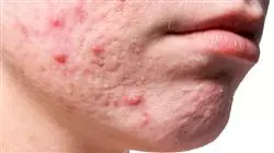 ##IMAGE##