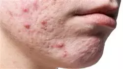 ##IMAGE##