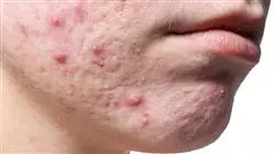 ##IMAGE##