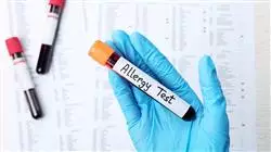 maestria online alergologia