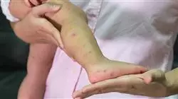 ##IMAGE##