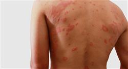 especializacion inmunodeficiencia y farmacología asociada a la patología alérgica