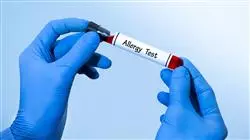 experto online inmunodeficiencia farmacologia asociada patologia alergica