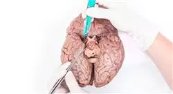 cursos neuroanatomia para médicos