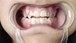 ##IMAGE##