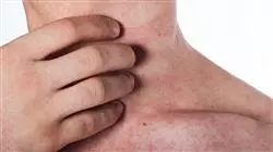 ##IMAGE##