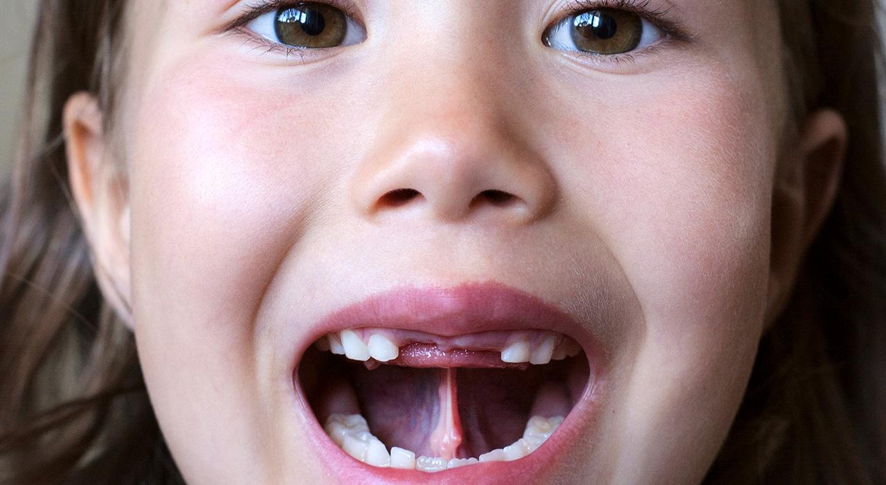 Maestría en Neurorrehabilitación logopédica y Análisis de Funciones Vitales. Terapia Orofacial y Miofuncional