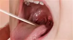 diplomado online tratamiento médico quirúrgico de la patología vocal
