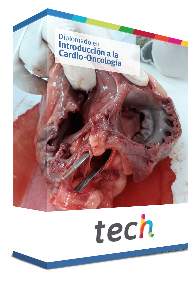 diplomado introduccion cardio oncologia caja