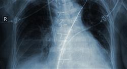 curso hipertensión arterial y enfermedad tromboembólica venosa relacionada con terapias oncológicas