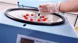 maestria online avances hematologia hemoterapia
