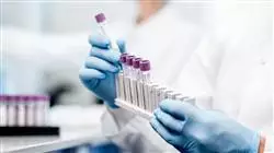 master online avances hematologia hemoterapia
