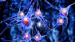 2 trastorno sueno cafaleas neuralgia