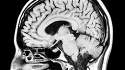 3 principales patologias neurologicas