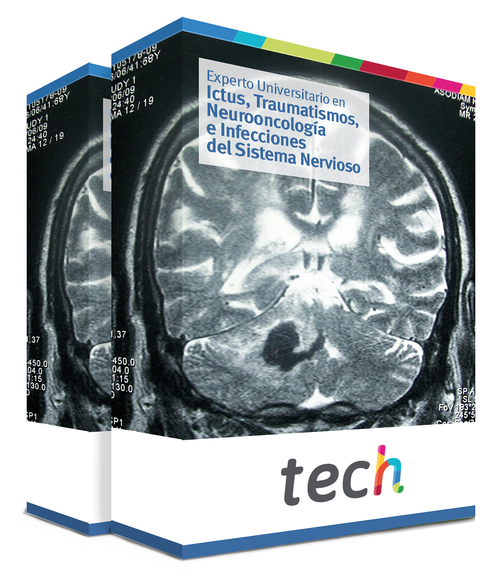 especializacion ictus traumatismos neurooncologia infecciones sistema nervioso caja