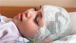 diplomado epilepsias