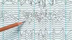 posgrado epilepsias