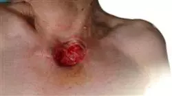 ##IMAGE##