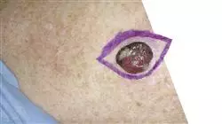 ##IMAGE##