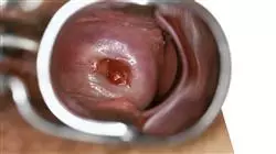 ##IMAGE##