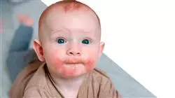 ##IMAGE##