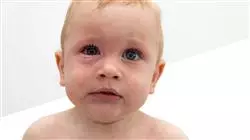 ##IMAGE##