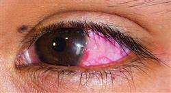 curso urgencias oftalmológicas y orl en atención primaria