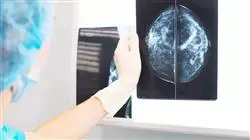##IMAGE##