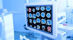 especializacion imagen clínica en patología del sistema nervioso central cabeza y cuello en emergencias y cuidados críticos