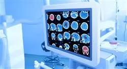 especializacion imagen clínica en patología del sistema nervioso central cabeza y cuello en emergencias y cuidados críticos