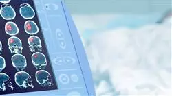especializacion online imagen clinica patologia sistema nervioso central cabeza cuello emergencias cuidados criticos