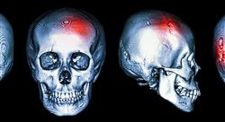 especializacion online imagen clínica en patología del sistema nervioso central cabeza y cuello en emergencias y cuidados críticos