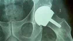 ##IMAGE##