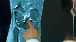 ##IMAGE##