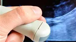 ##IMAGE##
