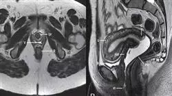 cursos imagen clinica patologia aparato urinario reproductor emergencias cuidados criticos