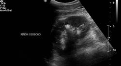 especializacion imagen clínica en patología del aparato urinario y reproductor emergencias y cuidados críticos