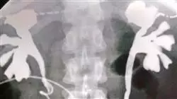 especializacion online imagen clinica patologia aparato urinario reproductor emergencias cuidados criticos